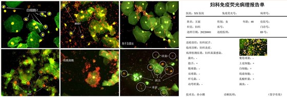 免疫荧光扫描分析仪